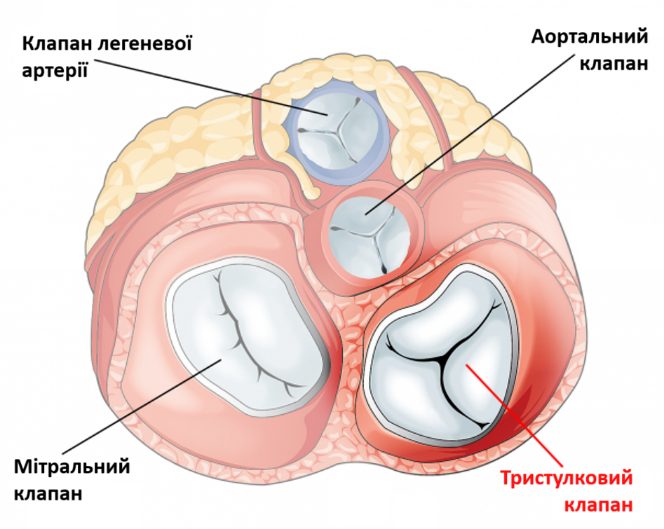 типи патологій тристулкового клапана