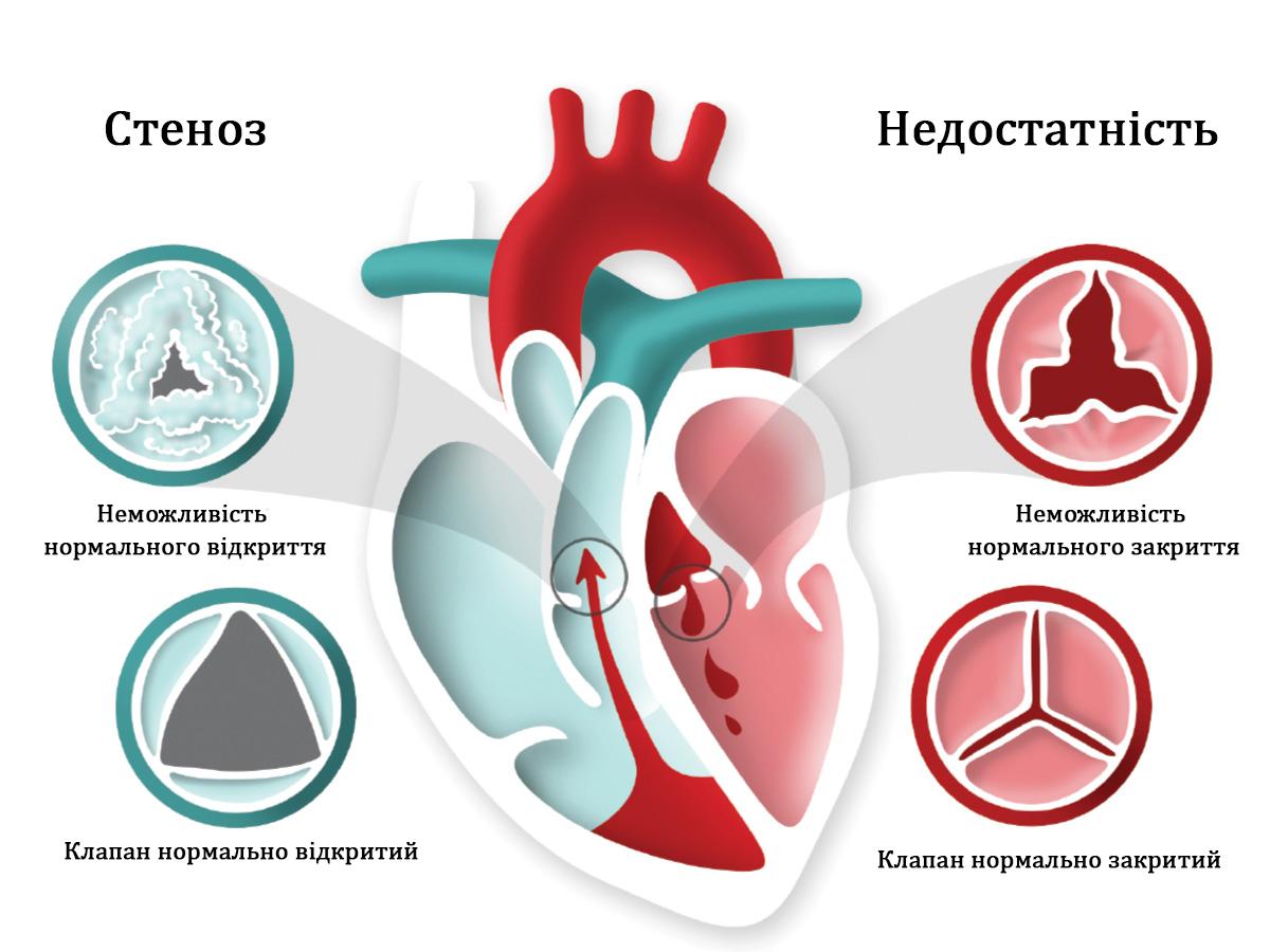 Операция Озаки