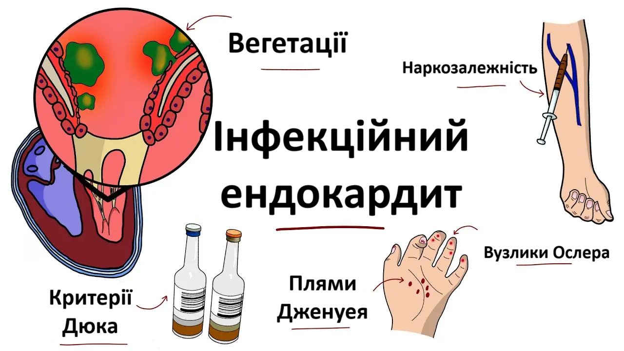 Діагностичні категорії за критеріями Дюка: